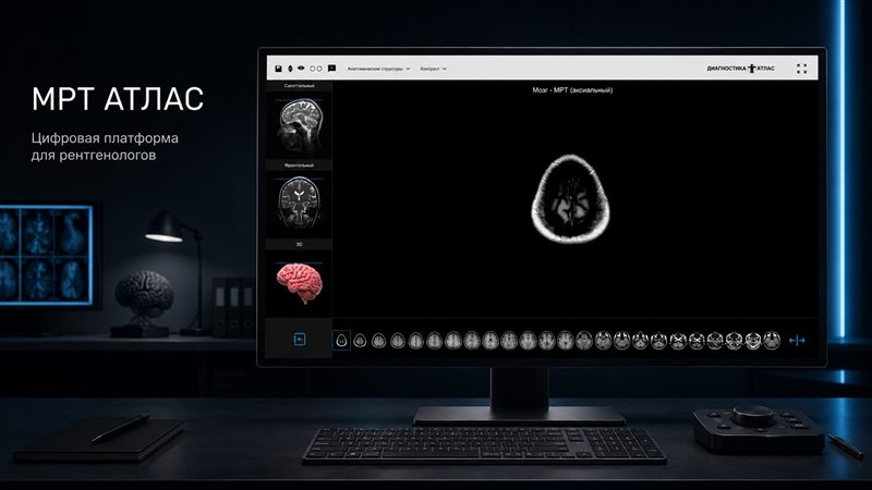Radiology Atlas — an ontech.pro web application